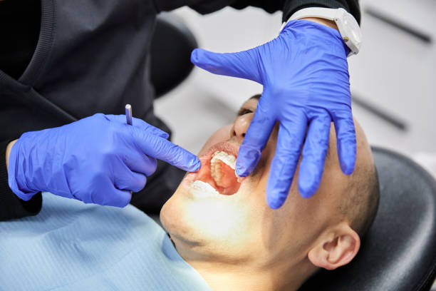 Best Urgent Care for Lost Fillings or Crowns in Buffalo, WY